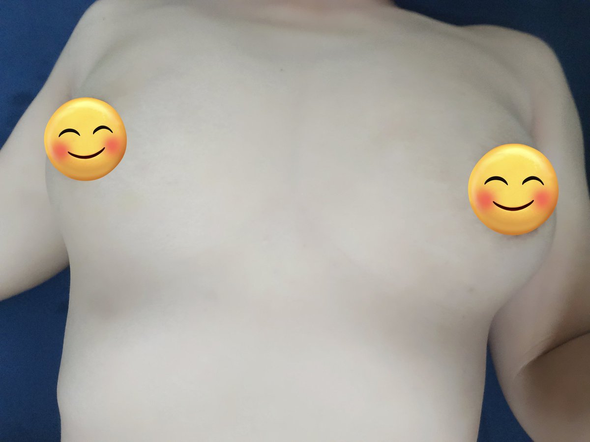 ร่างกายต้องการน้ำมัน นวดผ่อนคลายเบาๆ
#ชายเดี่ยวช่วยคู่ #ชายเดี่ยวนวดน้ํามัน 
#ขอนแก่นในเมือง