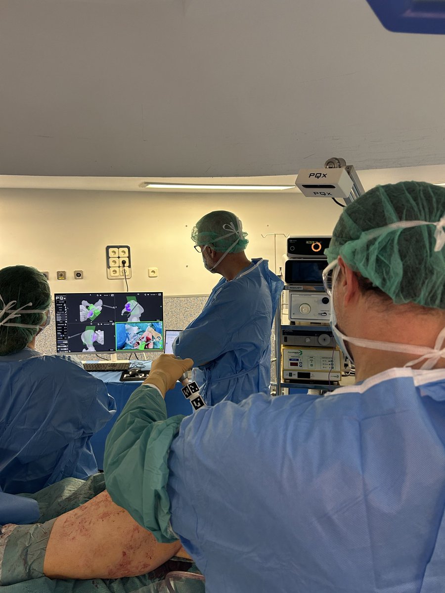 Cirugía tumoral de pelvis en el H. Clínico San Carlos de Madrid con el Navegador VEGA de Realidad Virtual y Realidad Aumentada. leiomiosarcoma pélvico. 
Doble Osteotomia en pelvis y sacro con el navegador Vega y guías YANKER navegadas y planificación quirúrgica Commander