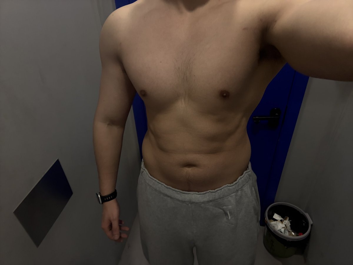 救命🆘从75kg涨到了90kg 再减下来会不会有赘皮呀！！！我的天