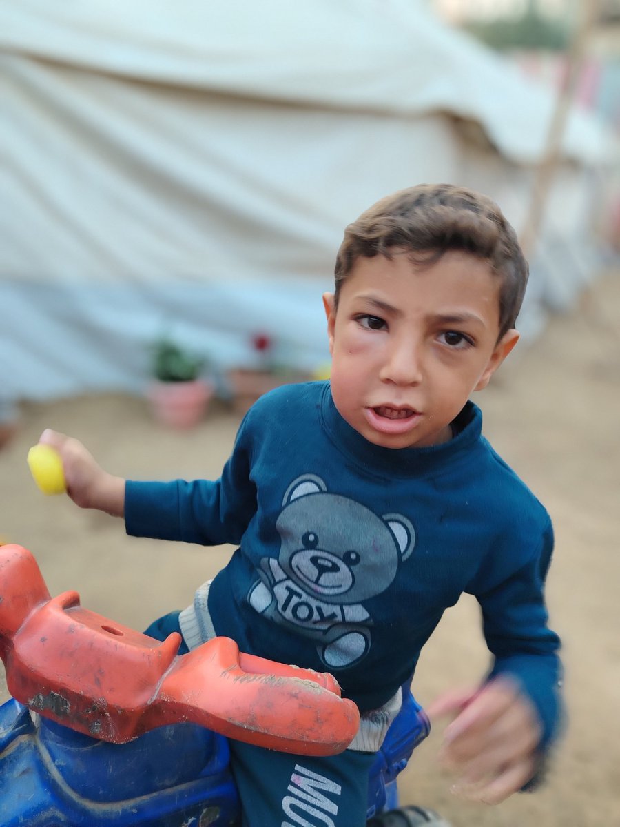 WafaaIn91's tweet photo. Youssef needs your support The link is here: https://t.co/lSN8bFrjNe #ChildrenOfGaza https://t.co/P09OFtRtGY
