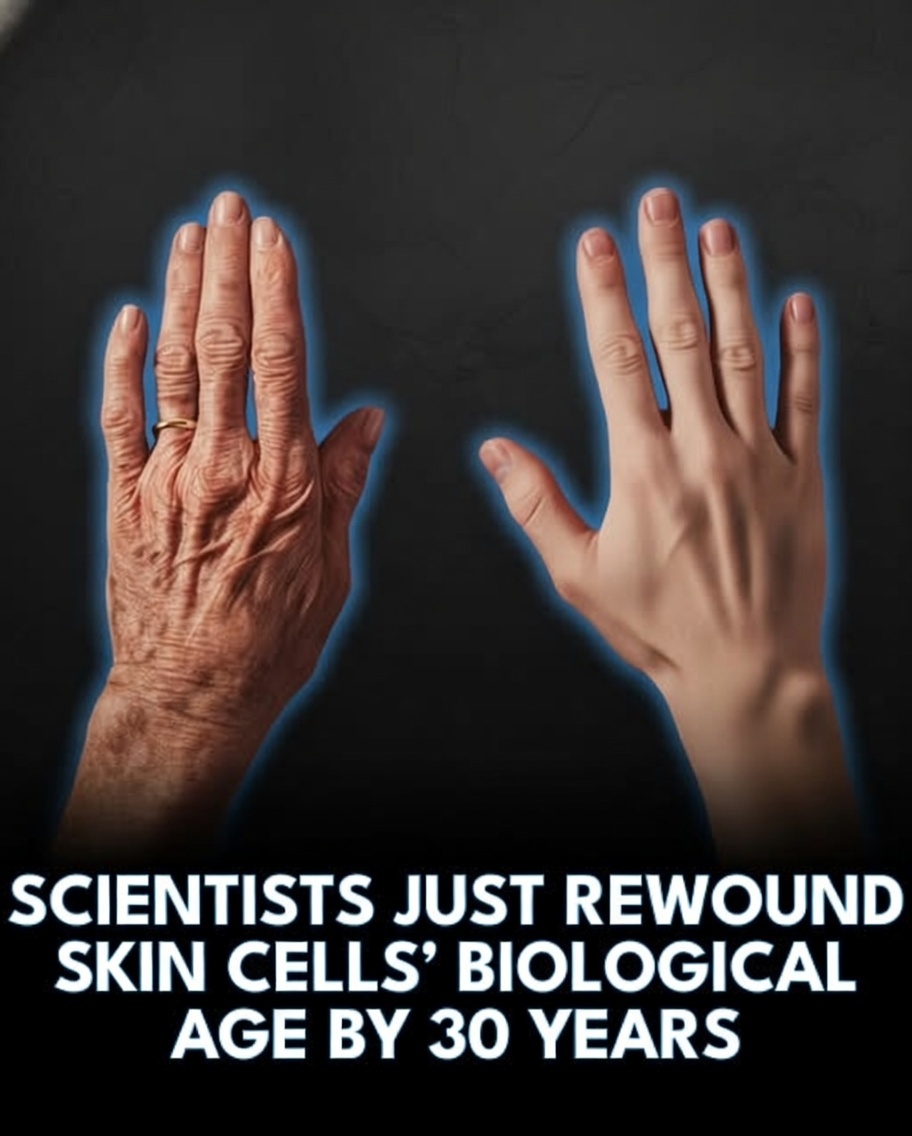 Rainmaker1973's tweet image. Scientists just made 50-year-old skin cells behave like they’re 20 again.

Researchers at the Babraham Institute in Cambridge have developed a groundbreaking method to reverse the biological aging of human skin cells by approximately 30 years, all while keeping them as fully…