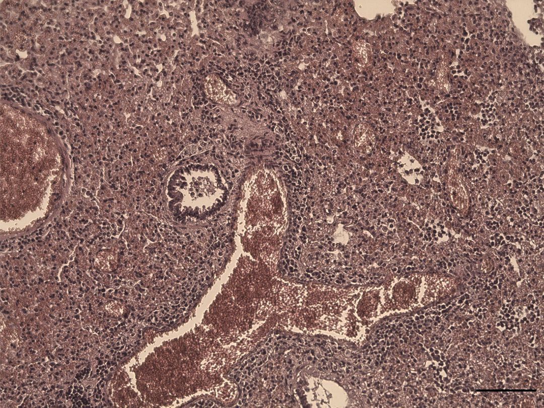 jclinicalinvest's tweet image. Secondary bacterial infections are a common complication in #influenza A infection, but targets for prevention are lacking.

Here, Susanne Herold &amp;amp; team suggest that targeting neutrophil-driven alveolar macrophage death in severe influenza #pneumonia strengthens host defense and