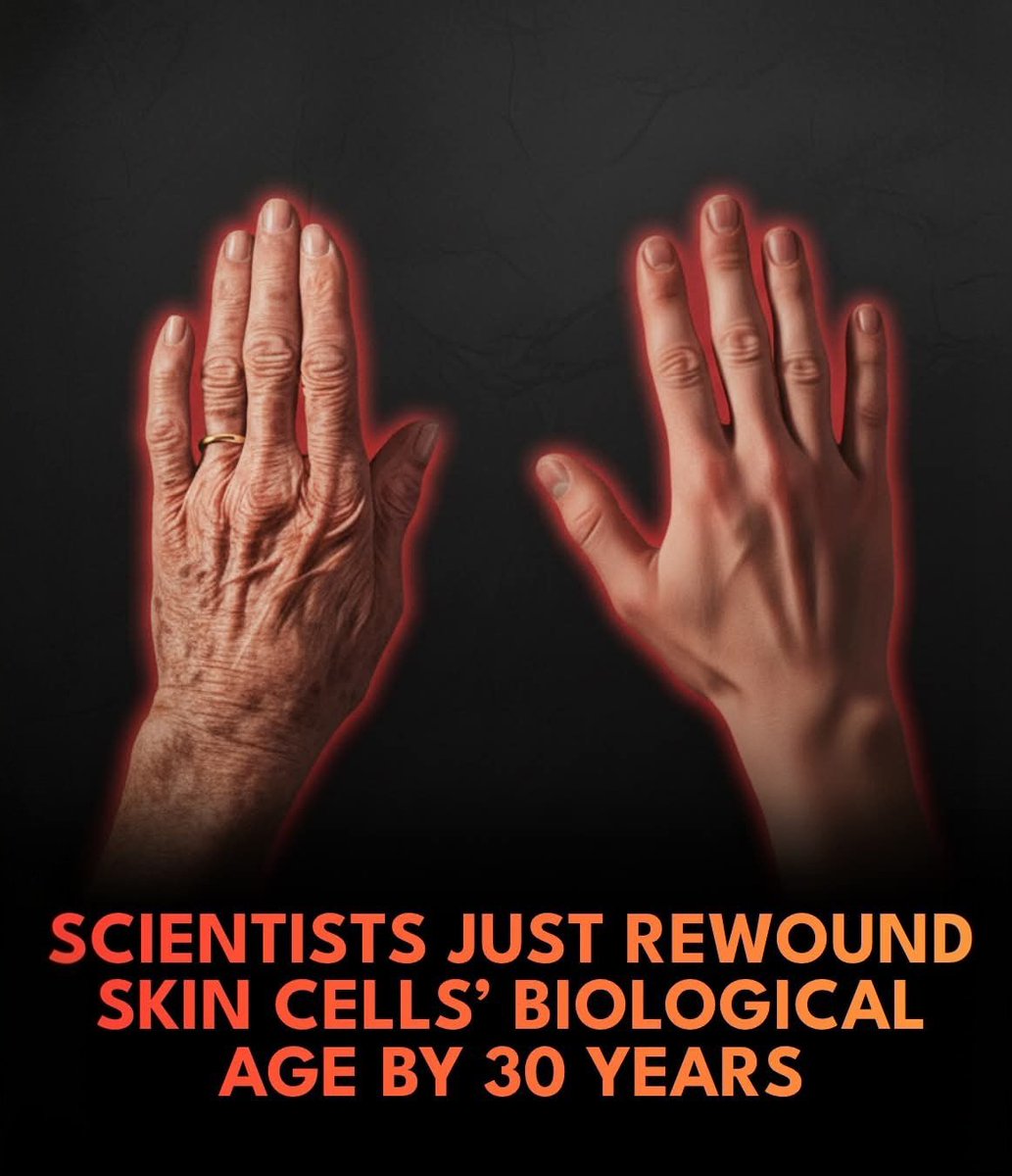 🚨 Scientists just made 50-year-old skin cells behave like they’re 20 again.

Scientists at the Babraham Institute in Cambridge have found a way to make old human skin cells behave as though they are about 30 years younger, without turning them into stem cells. Using a modified