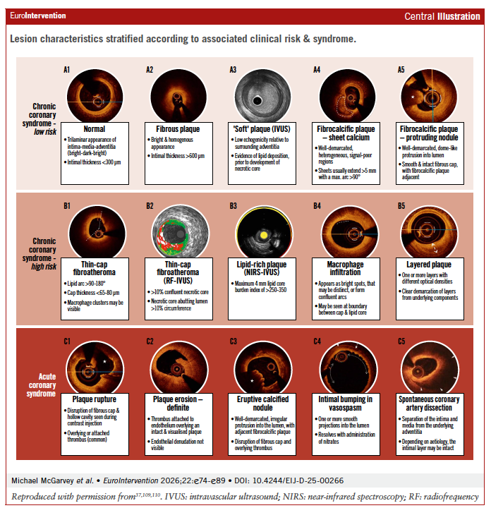 EuroIntervention tweet media