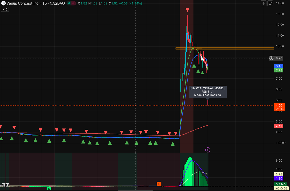 Jeff_Beach's tweet photo. 🚀 $VERO: The Sleeping Giant Just Woke Up—Is This the Start of a Multi-Bagga Run?

1/4 📈 Structural View: The Vertical Breakout Venus Concept ($VERO) just delivered a "God Candle," exploding from a multi-month consolidation base to hit $4.80. This isn't just a bounce; it's a massive structural shift backed by record-breaking institutional volume.

2/4 📊 Momentum Audit: MMs are Pushing the Tape

RSI: Currently sitting at 58.88, which is remarkably healthy after such a move. It shows we have significant "oxygen" left before hitting the extreme overbought danger zone.

EWO: Printing a massive green momentum spike, confirming that the trend is now firmly in "Bull Mode".

Support: The previous heavy resistance at $2.13 (SMA 200) has now been converted into the ultimate macro floor.

3/4 🎯 The Target: Hunting for Blue Skies Our Institutional Pro V2 model identifies the next major liquidity magnets:

Immediate Target: Reclaiming and holding the $5.00 psychological level.

Strategy: The "rubber band" is currently stretched. I am watching for a healthy back-test of the $3.67 zone to provide the high-probability re-entry for the next impulsive leg.

4/4 📲 Capture the Alpha Don't chase the top of a vertical wick. I am monitoring the 15-minute "Fast Tracking" cross to signal the exact moment the next accumulation phase ends.

👉 Add my WhatsApp via the link in my Bio for the real-time entry alert and full script access!

#VERO #VenusConcept #Stocks #ElliottWave #TradingStrategy #TechnicalAnalysis #Investing