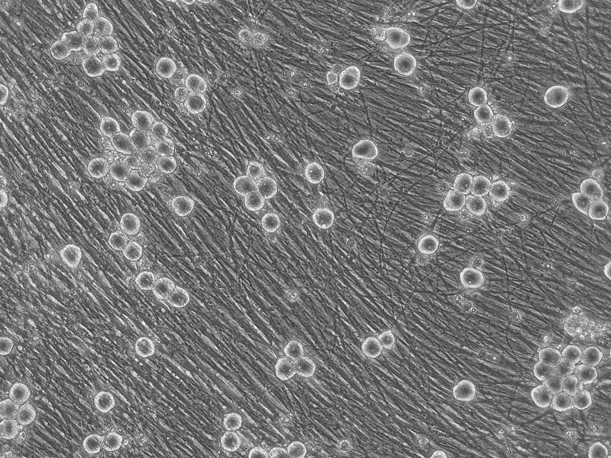 AnatomicTech's tweet photo. NEW Human Trigeminal Neurons for #MigraineResearch!
Phase-contrast images from our newest human iPSC-derived trigeminal neurons show high neuronal purity-no mitomycin C needed. Follow us for updates on functional characterization of migraine &amp; pain targets #NotYourAverageNeuron https://t.co/oNrrYlfml0