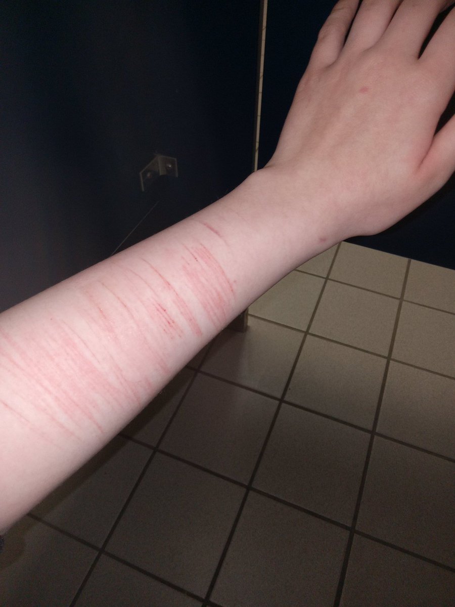 decayedv0mitpup's tweet photo. Cat scratches ! ♡
Why do these hurt so much more than styros and beans (╥﹏╥) https://t.co/ycCV89Z0vc