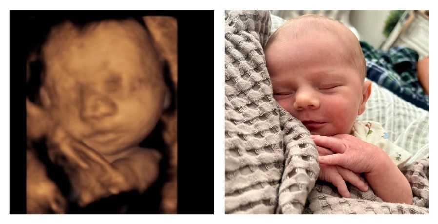 GREAT NEWS! Florida Heartbeat Law is Saving 300 Babies From Abortion Every Month lifenews.com/2025/10/02/flo…