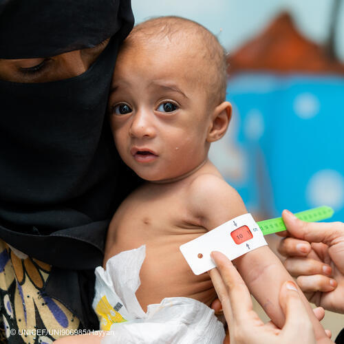 UNICEF_Yemen's tweet image. Hafedh, 10 months old, in his mother's arms while the doctor is assessing his vital signs at the #UNICEF supported #therapeutic feeding center (TFC) in #Khawkha #Hudaydah, September 2025.
Children in #Yemen deserve #Peace &amp;amp; healthcare.

Thx to support from @UNCERF &amp;amp; @FCDOGovUK!