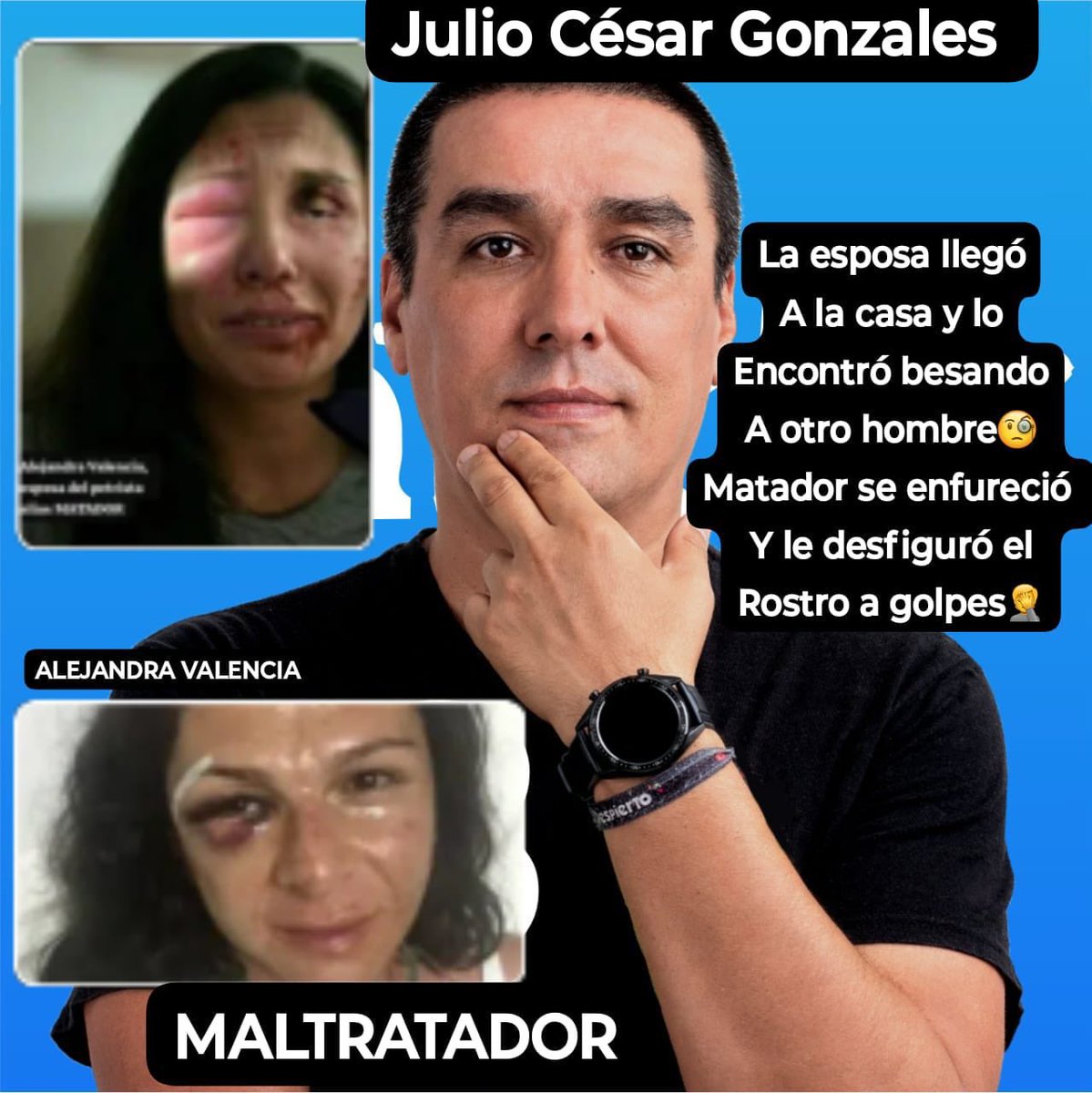 jpradach1's tweet image. #MatadorGayArrepentido
#MatadorGolpeadorDeMujeres
La esposa entró a su casa..
Vió a Matador besando a un tipo..
Y Matador ante el Reclamo de su esposa la agarró a pata y la dejó así 👇.