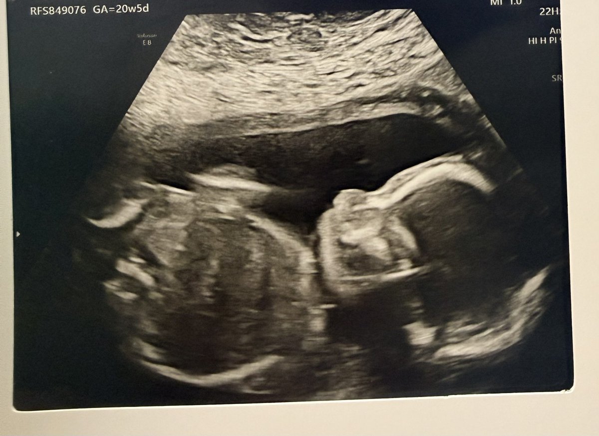 My favourite part of the week 💕 I cannot believe how fast this pregnancy is going! So excited to meet you little lady 🥰