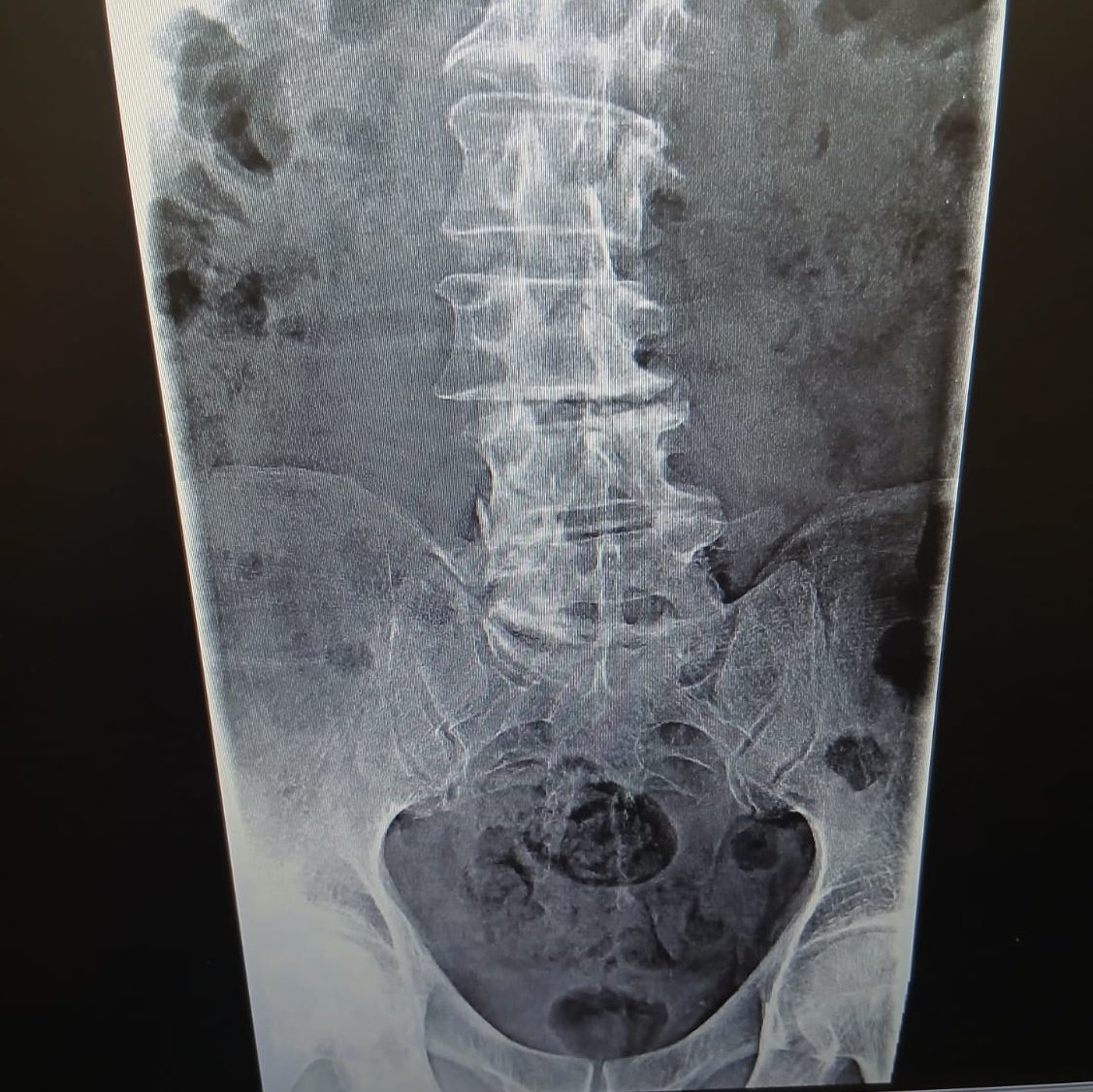 mazen_msallam's tweet image. Don't forget us, we desperately need your help. Please help and share; we are suffering.💔❤️‍🩹😥