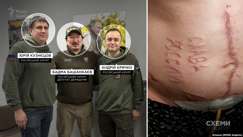 ЗМІ встановили російських хірургів, які випалили "Слава России" на тілі українського полоненого

censor.net/ua/p3596430