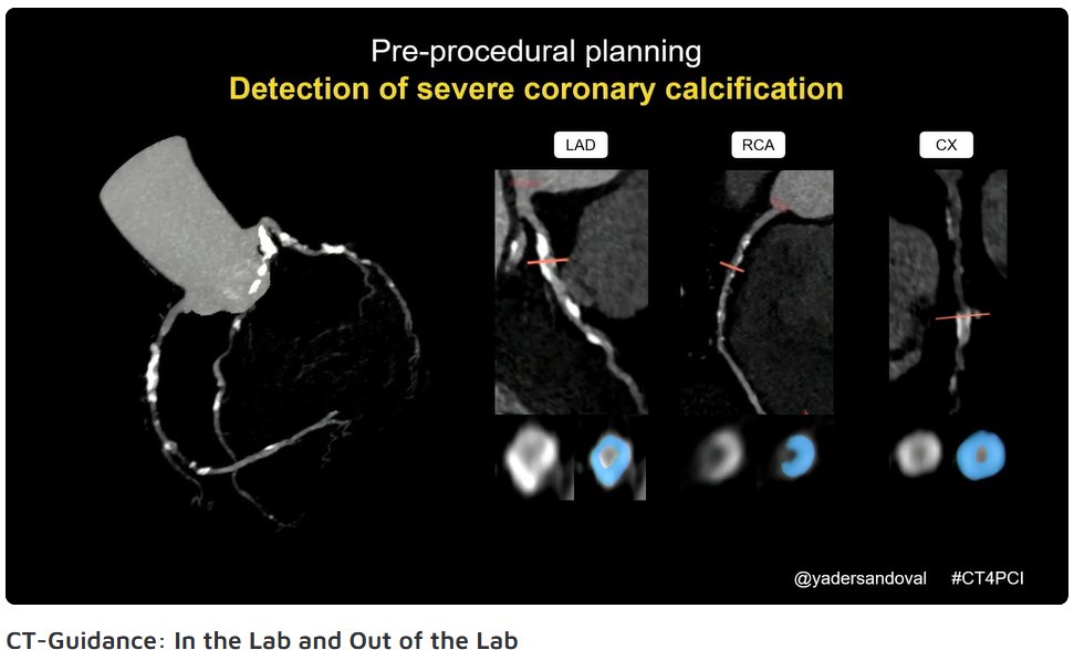 American College of Cardiology tweet media