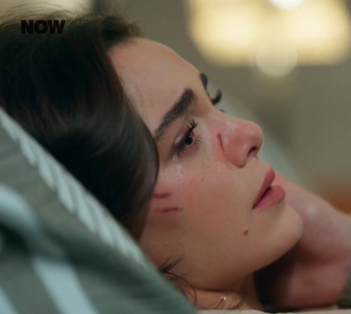 حتى الجروح ماتأثر على جمالها