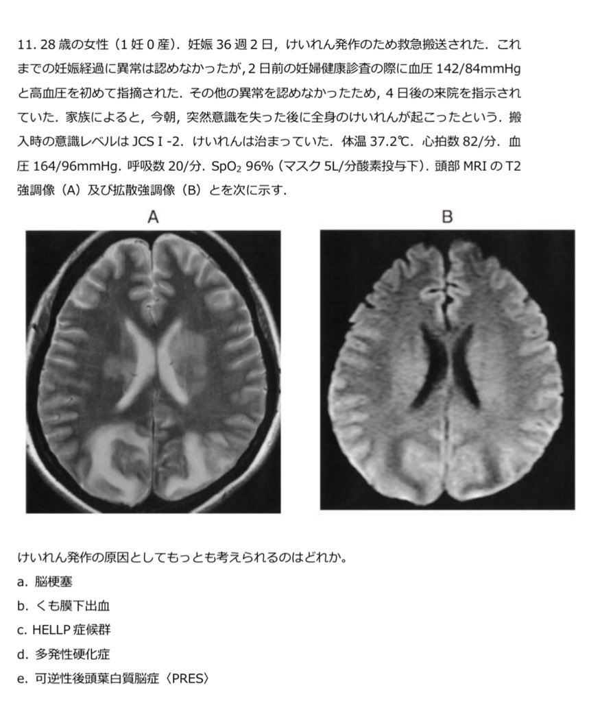 答えになります。 センシティブ設定にて投稿させていただきます。