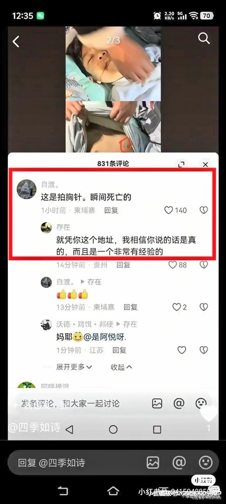 原来这就是他们的杀人凶器:拍胸针
