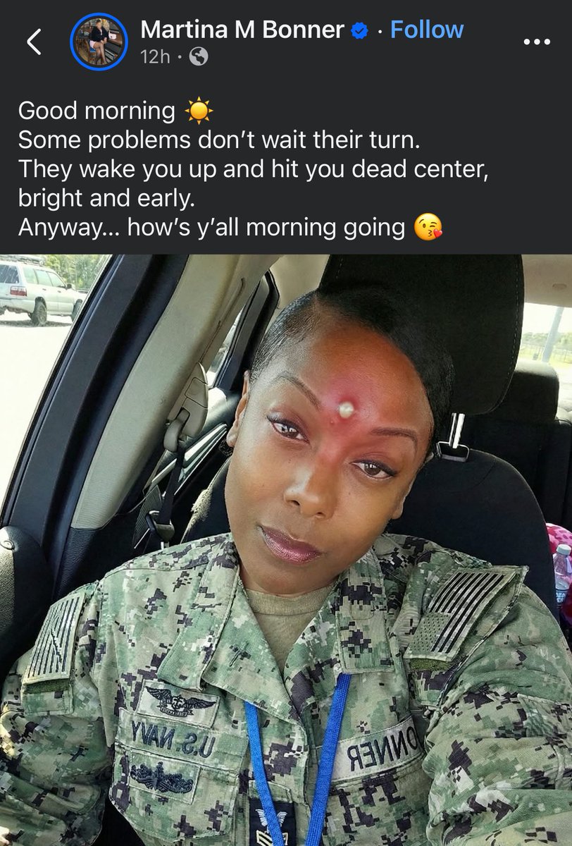 ISLANDBOYY11's tweet image. this lady on facebook said she woke up with this on her forehead—