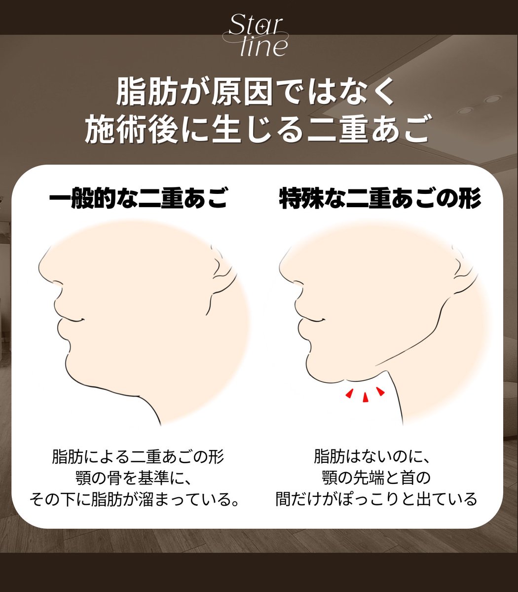 【切開リフト・脂肪吸引専門】 スターライン美容外科 tweet media