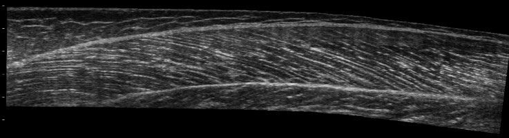 Anthony Blazevich tweet media