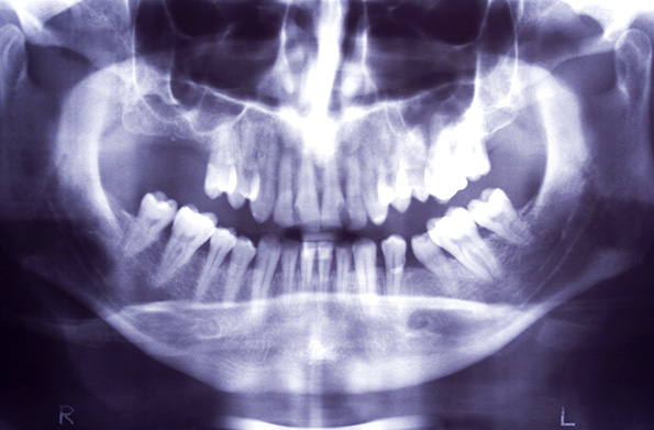 久しぶりの歯医者さん。
しばらく通ってキレイにして貰おうw
#画像はイメージです