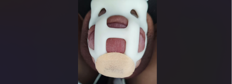 锁头上的孔洞会硌肉，龟头嵌进去很疼怎么办？
大致三个方法吧，
一、是如果包皮长，可以把包皮覆盖住龟头后戴，用包皮垫在孔洞上。
二、是很多小男娘会用丝袜或湿纸巾垫在那里然后戴。