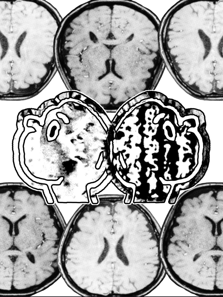 GUCCIFANTASTIC's tweet photo. Peace Love and Creativity to All ✌️🧠

-

First Two Pieces of Art I’ve let the world see, Untitled,
Both Shown at My Private Album Listening Party 🎵💟👁️
#pondererworld 

The Wait is Almost Over ⌛️👂 https://t.co/YgvS02mR51