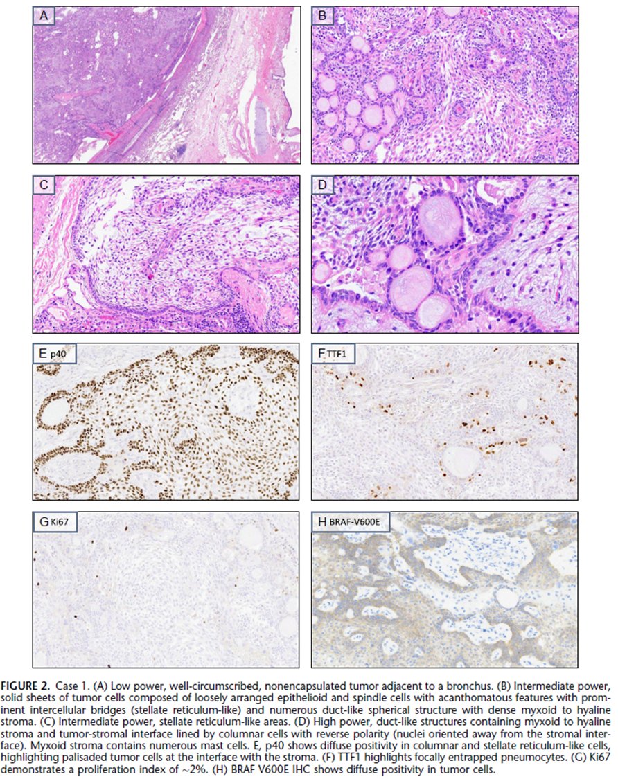 Natasha Rekhtman MD PhD tweet media