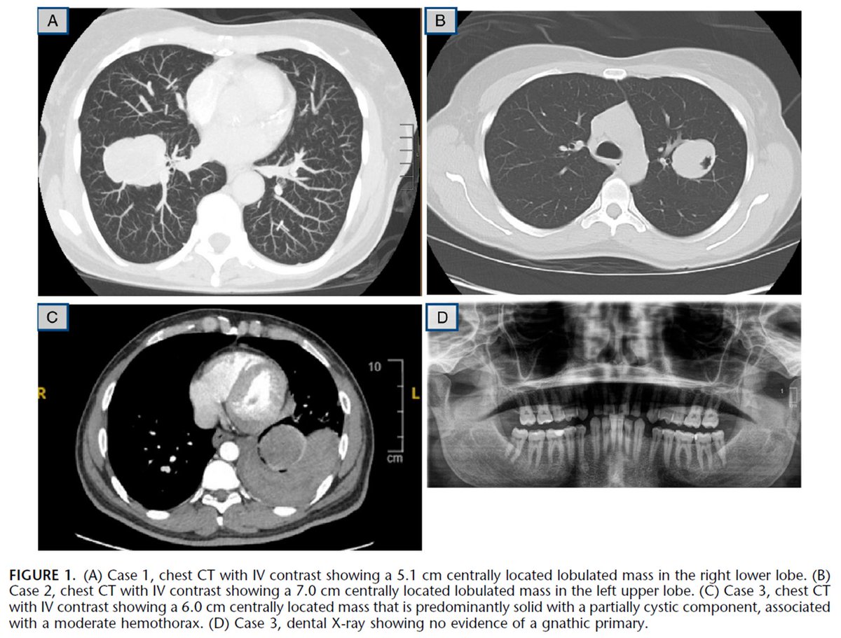 Natasha Rekhtman MD PhD tweet media