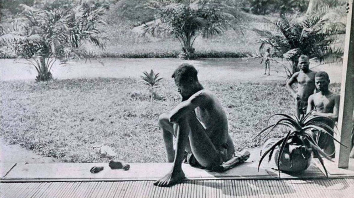 아 다섯살이엇네요..
적나라하지는 않다만 사진 볼 때 주의해주세요

손목 절단에 관련하여 남아잇는 사진들은 대부분 일제처럼 과시용이 아니라 참상을 고발하기 위해 찍힌 사진들입니당