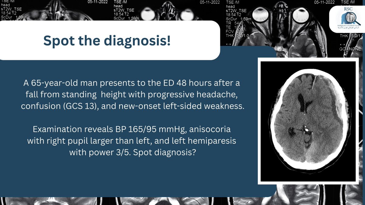 Radiology Club tweet media
