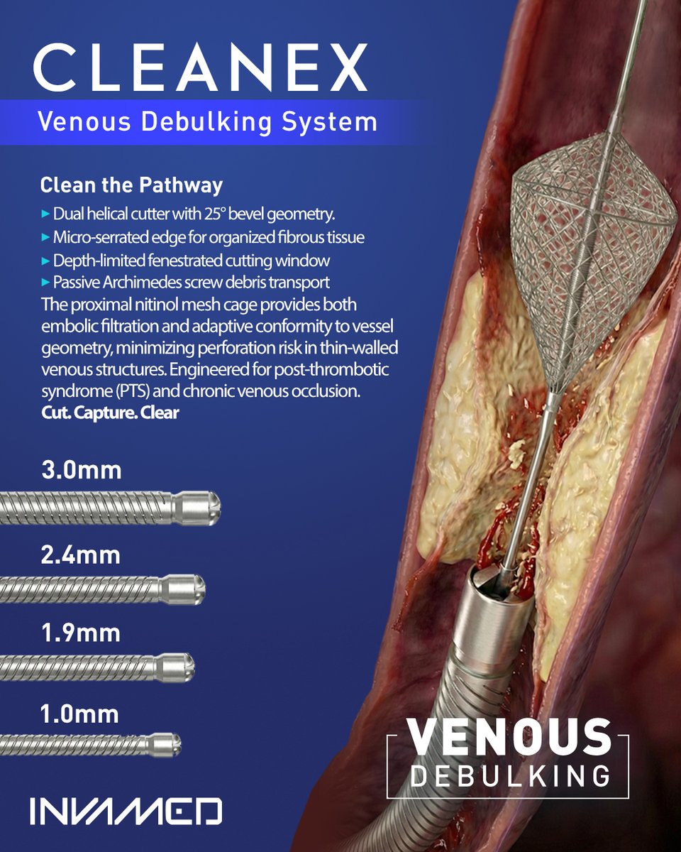 invamed_inc's tweet photo. CLEANEX™ Venous Debulking System
Clean the Pathway.

Post-thrombotic syndrome presents a unique challenge: 
organized fibrous tissue, synechiae, and chronic 
venous remodeling—not atheroma.

CLEANEX is purpose-engineered for venous pathology. 
The dual helical cutter with micro-serrated edges 
addresses fibrotic tissue while the integrated nitinol 
mesh cage provides embolic protection.

Chronic venous obstruction demands venous-specific 
engineering.

Cut. Capture. Clear.

#INVAMED #CLEANEX #PTS #ChronicVenousDisease 
#VenousIntervention #Phlebology