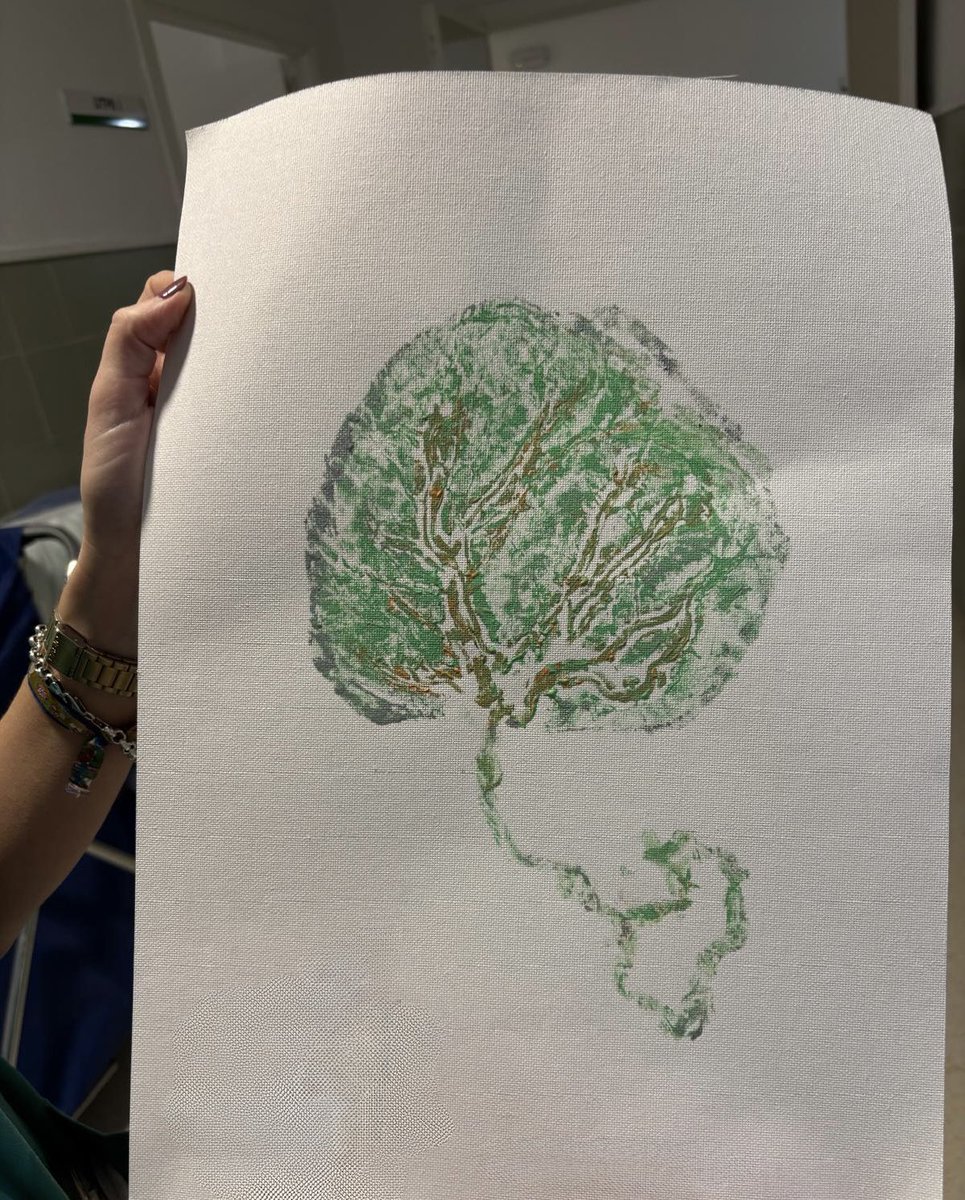 Nohhya's tweet image. Guardias entretenidas….#matronas #reciennacido #vida #latido
Y de fondo…@AlejandroSanz ☺️🥰