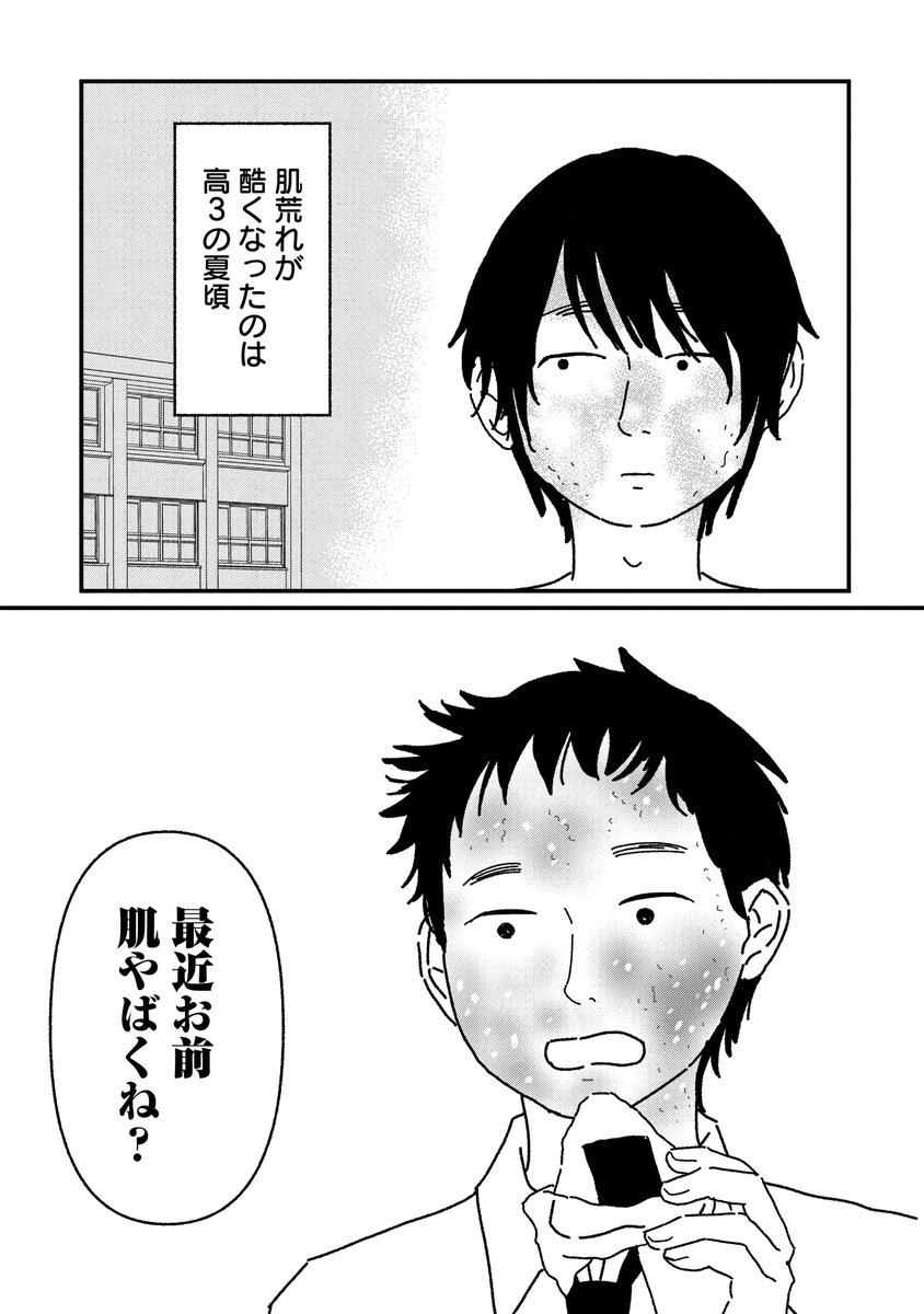 bera_kaneko's tweet photo. 肌荒れが急に止まらなくなった話(1/4) https://t.co/3UB8HkAAw5