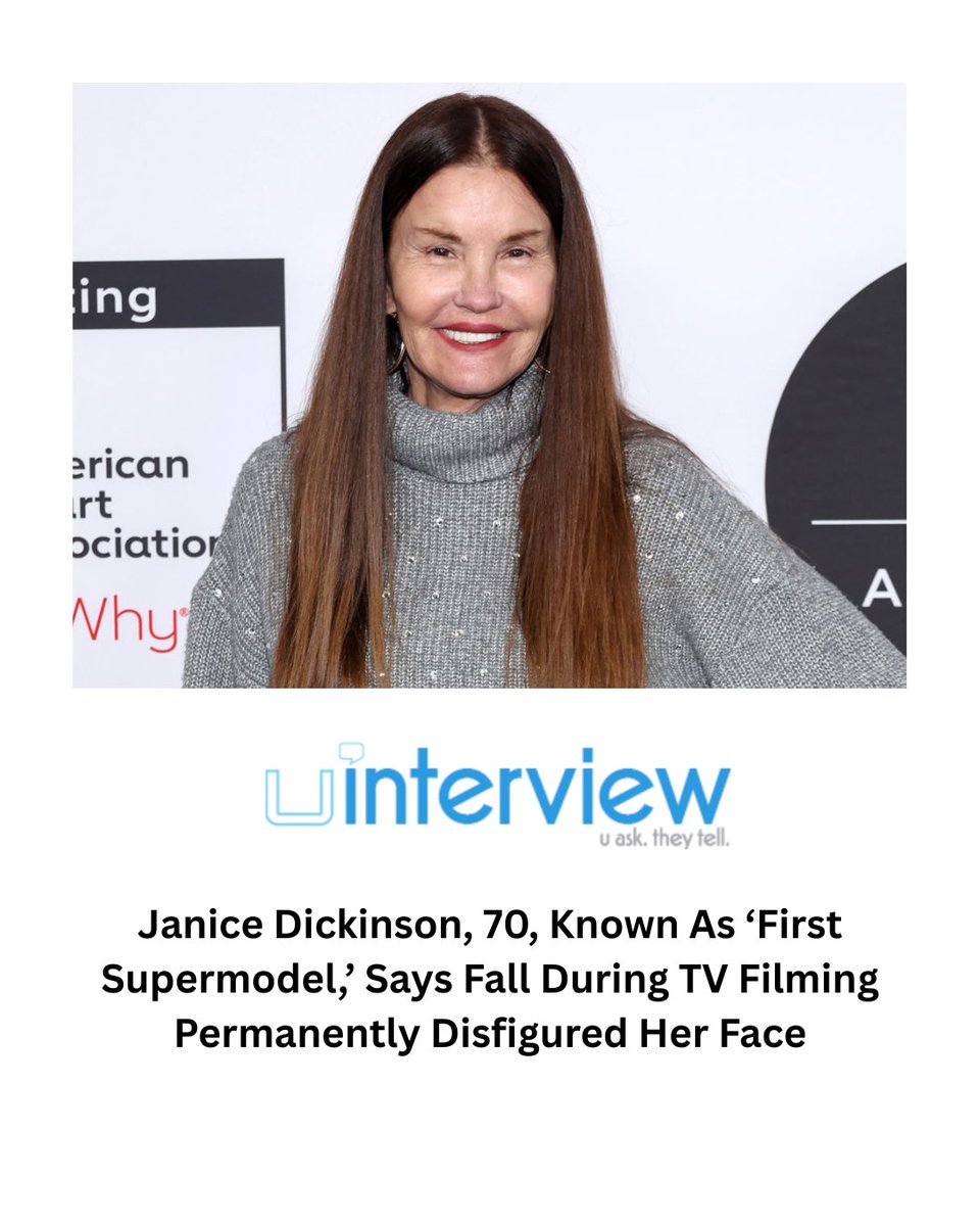 uinterview's tweet image. Janice Dickinson, 70, Known As ‘First Supermodel,’ Says Fall During TV Filming Permanently Disfigured Her Face

#Janice #Accident #Supermodel

Follow @uinterview for the best viral videos, celebrity interviews, and news

Read More: uinterview.com/news/janice-di…