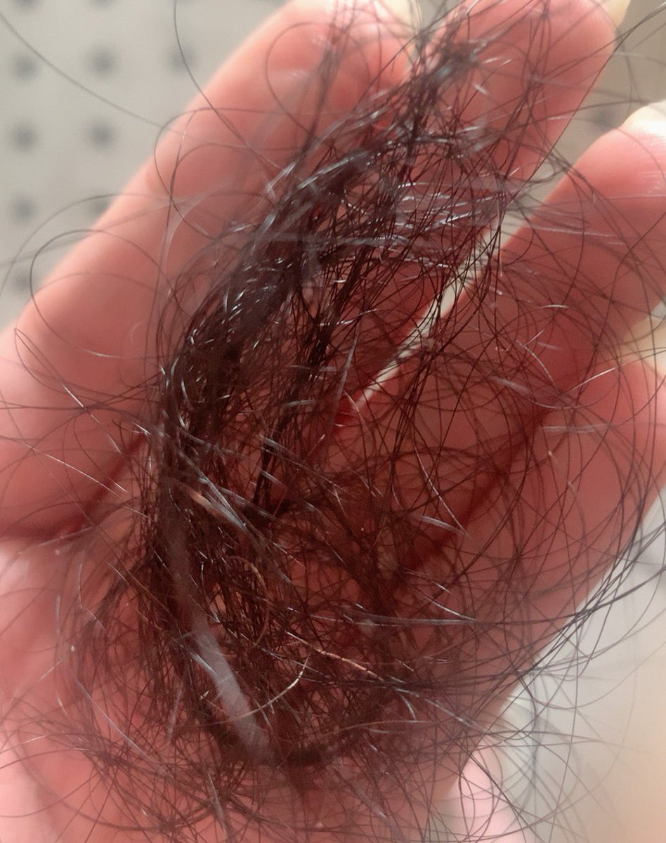 头发长了看着一直掉头发好难受啊