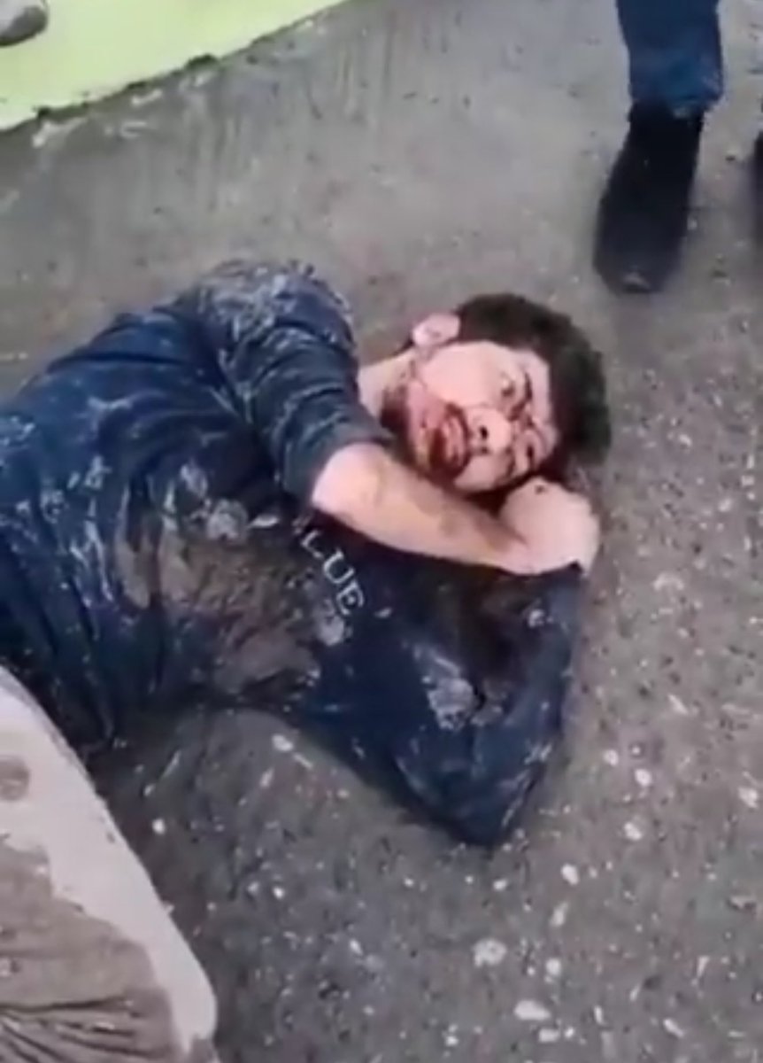 Türk bayrağını yakan kürdofaşistin öncesi sonrası. Ona bu toprakların Türkiye olduğunu hatırlatmışlar.