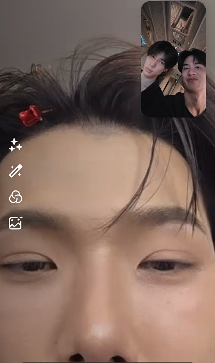 คนที่นิ้วหักผ่าเสร็จแล้วไปทำงานต่อพร้อมส่งรูปนิ้วเบี้ยวๆแต่หน้าเปื้อนยิ้มมา น่าพรั่นพรึงกว่ามาก