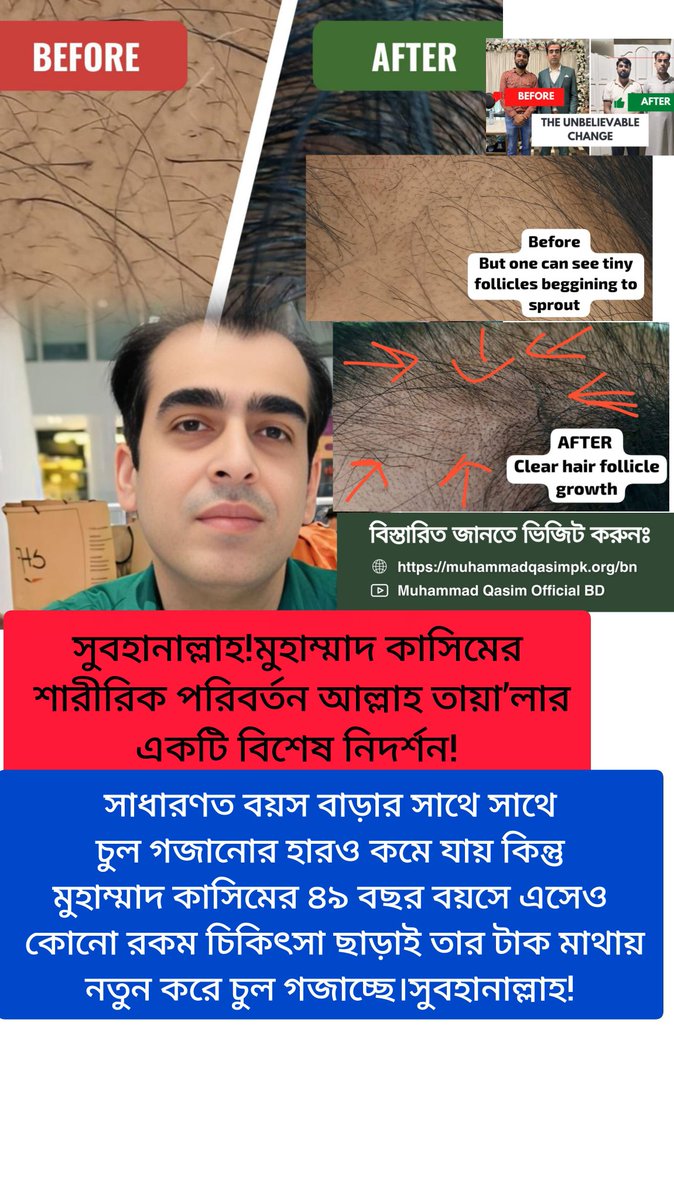 shailaKhan7375's tweet photo. বৈজ্ঞানিকভাবে, তার রূপান্তর বার্ধক্য এবং জীববিজ্ঞানের স্থির দৃষ্টান্তগুলিকে চ্যালেঞ্জ করে। আধ্যাত্মিকভাবে, এটি ঐশ্বরিক নির্বাচন এবং ভবিষ্যদ্বাণীমূলক প্রতীকবাদের প্রাচীন নিদর্শনগুলির সাথে সামঞ্জস্যপূর্ণ। - Muhammad Qasim https://t.co/2SeWber6Vq