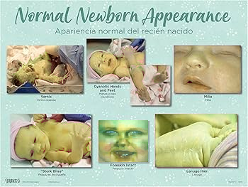 pissfaggots's tweet photo. @PopCrave ❤️of course loving this and sending gifts of love to loving mother 

💔but noticing Mikey Moon has wrong skin coloration that might be permanent.. please make sure your surrogate drinks enough pigmentation when she is glowing😟

please reference diagram to find normal newborn: https://t.co/CnPzRLJYDc