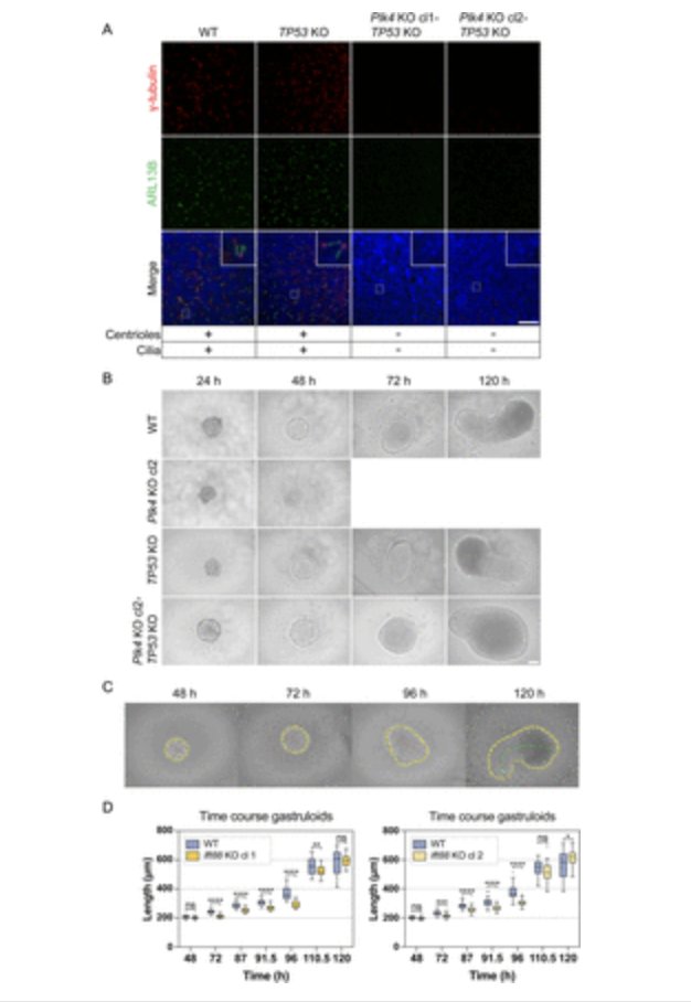 AMartinezArias's tweet image. More #gastruloids papers now starting to be used to test #CellBiology  - #CellCycle and #Cilia –
biorxiv.org/content/10.648…
life-science-alliance.org/content/9/1/e2…