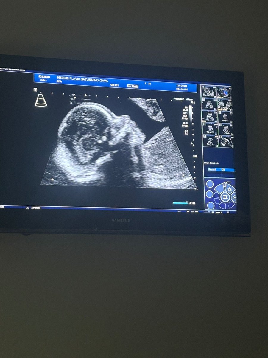 FlavinhaGava's tweet photo. 6 meses gerando o amor da minha vida 😍🤏🏻 falta só mais 3 meses p ver seu rostinho. https://t.co/A7llPgm7cm