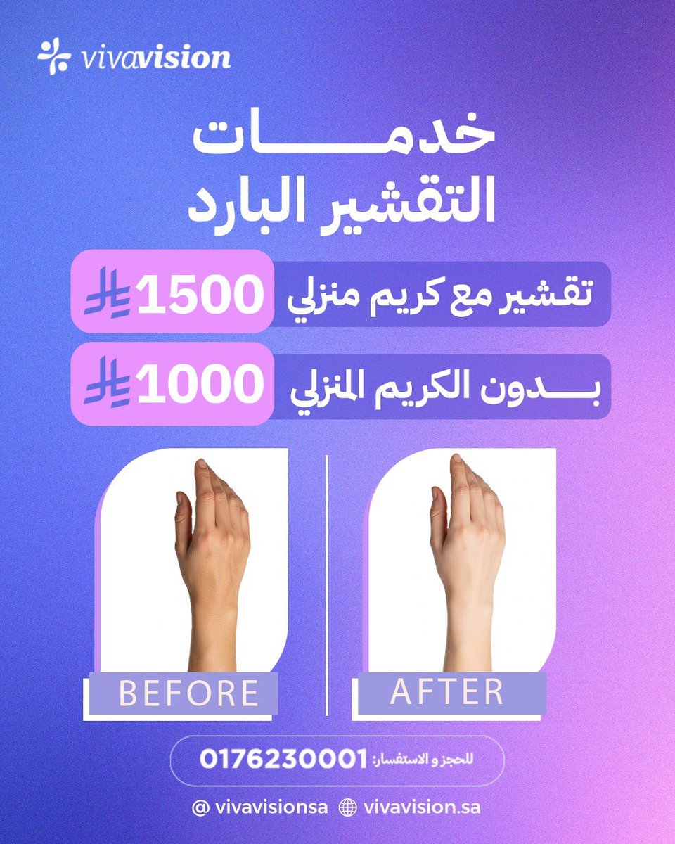 vivavisionsa's tweet photo. لفرق واضح احجزي جلستك الآن في مركز فيفا فيجن الطبي ❤️

📌 للاستفسار تواصل على:
0176230001

#مجمع_فيفا_فيجن_الطبي  #قسم_الجلدية 
#تجميل https://t.co/6gyeAGzdUi