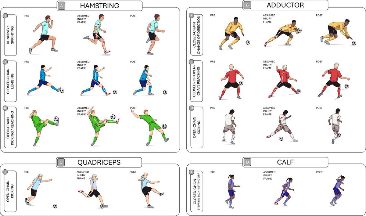 BJSM_BMJ's tweet image. ⚠️ Qualitative and quantitative situational characteristics of muscle strains in sports 💪

New systematic review and meta-analysis 📄

Find out more ➡️ bit.ly/4pNNcvu