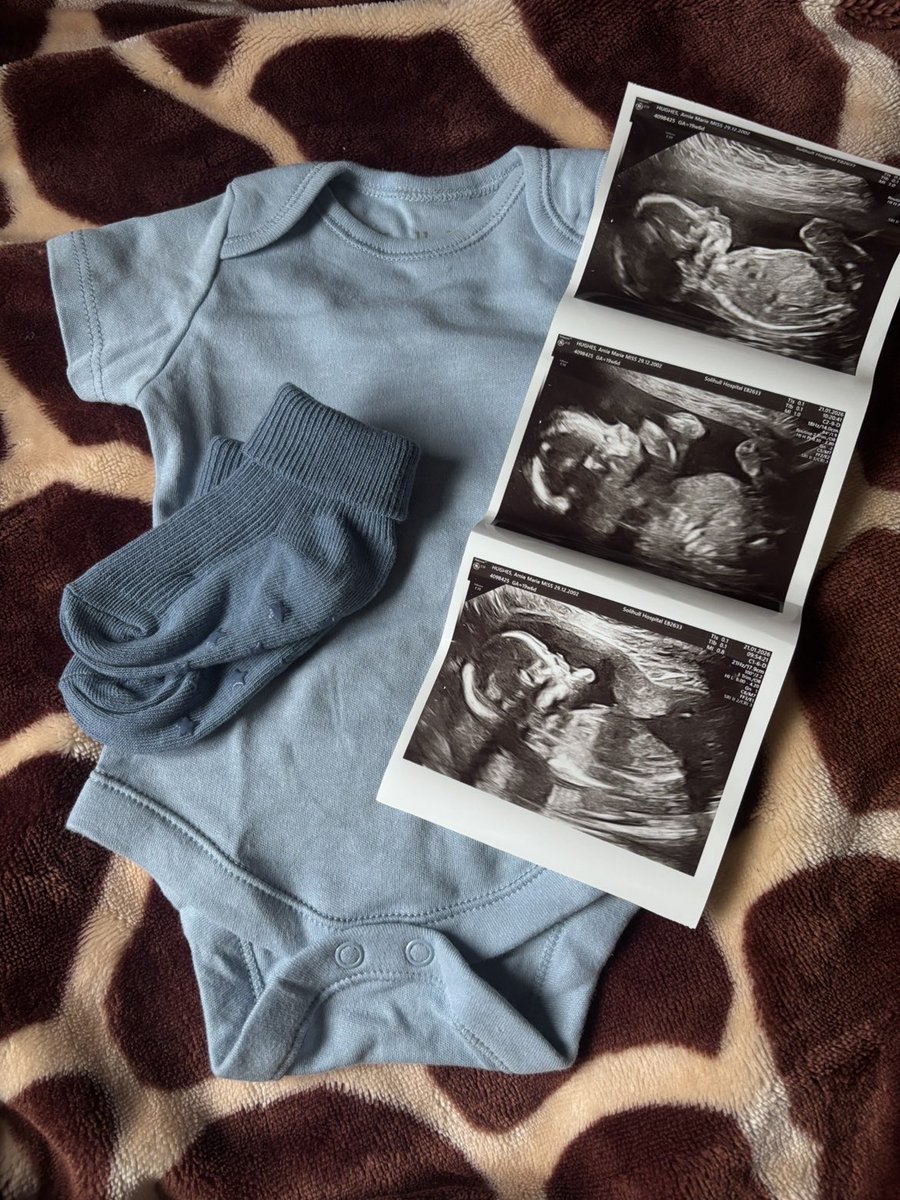 Lewis // Medz tweet media