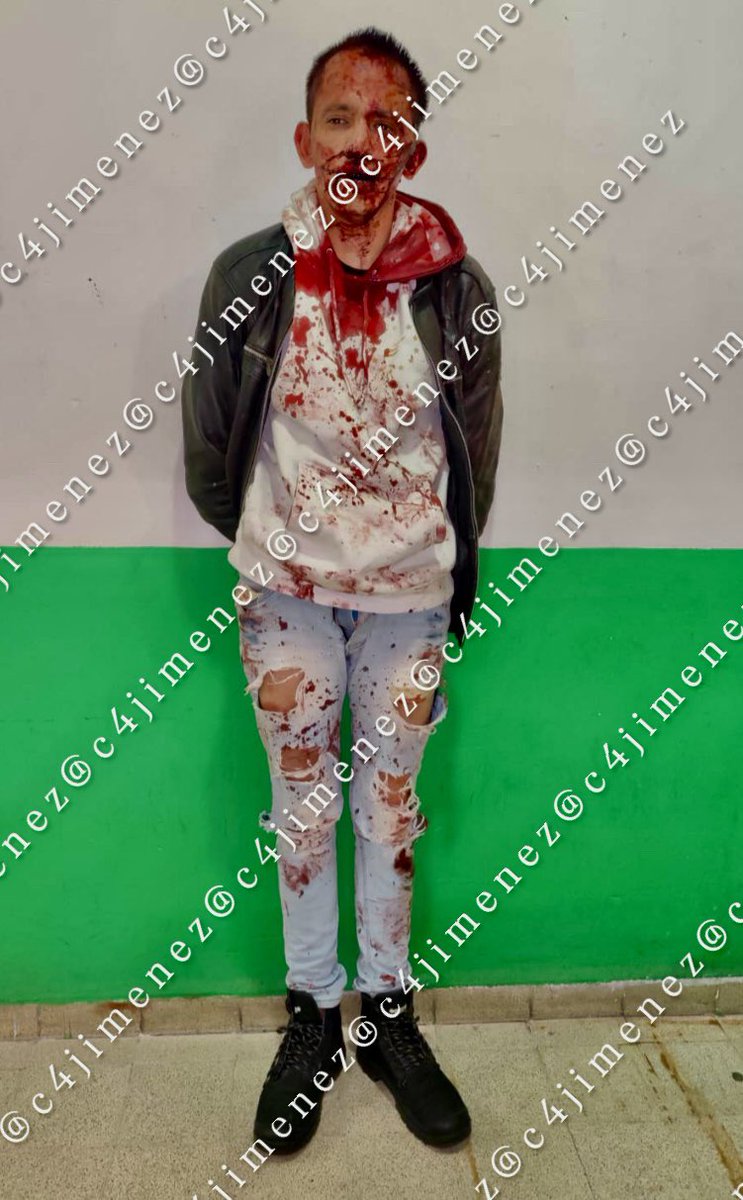 c4jimenez's tweet photo. LE PARAN una JODA a ABUSADOR
José Campos
Andaba en un Jetta por la zona de @TlalpanAl 
Subió a jalones a una joven q estaba en la calle.
Intentaba abusar de ella, cuando vecinos lo descubrieron.
Así lo reventaron.
Agentes de @SSC_CDMX lo detuvieron y llevaron a @FiscaliaCDMX https://t.co/pTJw1V1oKi