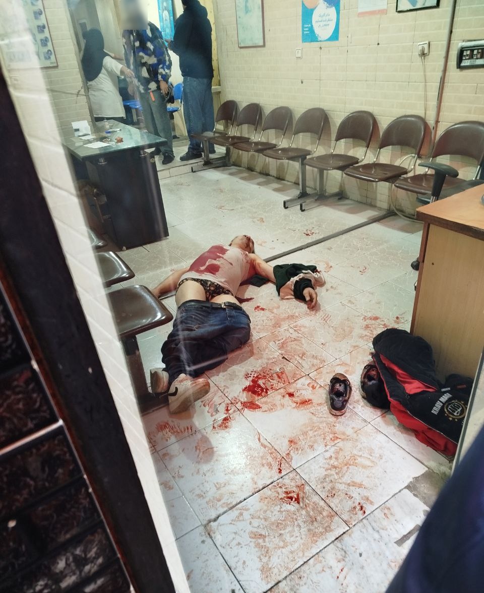 This is what Khamenei does to men who went out to protest for freedom in #Iran.