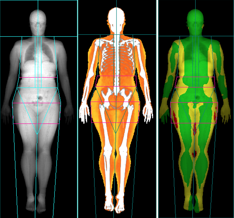 DEXalytics's tweet photo. What Is the Soft Tissue-To-Bone Ratio?
In this new blog post, Dexalytics Co-Founder Don Dengel discusses another ratio that his laboratory has started to explore, the Soft Tissue-To-Bone Ratio.
Learn more here: https://t.co/T0I8J90ZSO
#DXA #Bodycomposition https://t.co/1mnpSt0mDI