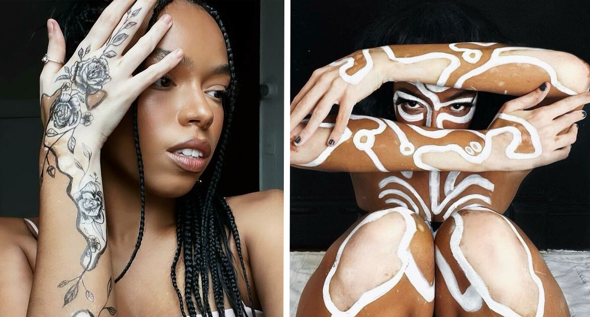 ZorzStudios's tweet photo. Amara Aleman’s “ArtSpots”: transforming vitiligo into #VibrantArt (20 pics) https://t.co/kO4FFidFyb 

#SaumyaRatan #art #AmaraAleman #artist #vitiligo #BodyArt #VitiligoArt #UniquePatterns #ArtSpots https://t.co/7NAOBHvmIy