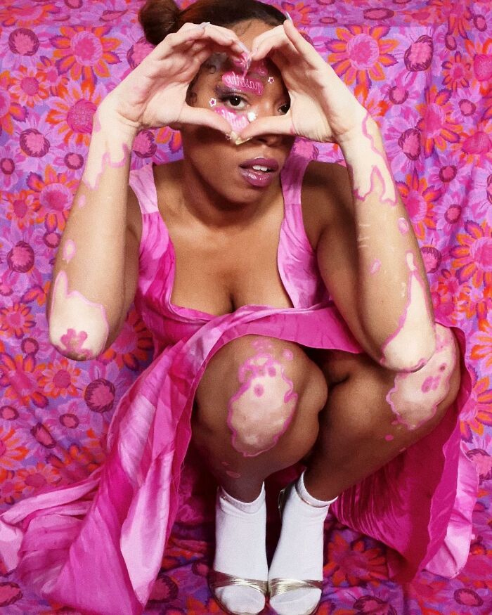 ZorzStudios's tweet photo. Amara Aleman’s “ArtSpots”: transforming vitiligo into #VibrantArt (20 pics) https://t.co/kO4FFidFyb 

#SaumyaRatan #art #AmaraAleman #artist #vitiligo #BodyArt #VitiligoArt #UniquePatterns #ArtSpots https://t.co/7NAOBHvmIy